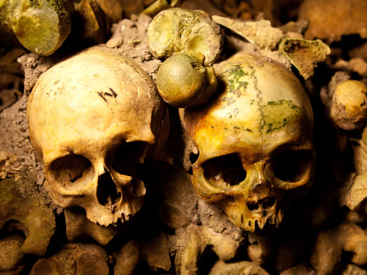 Transforming Spinal Treatment: Dr. Rao, the Exceptional Spine Specialist of India