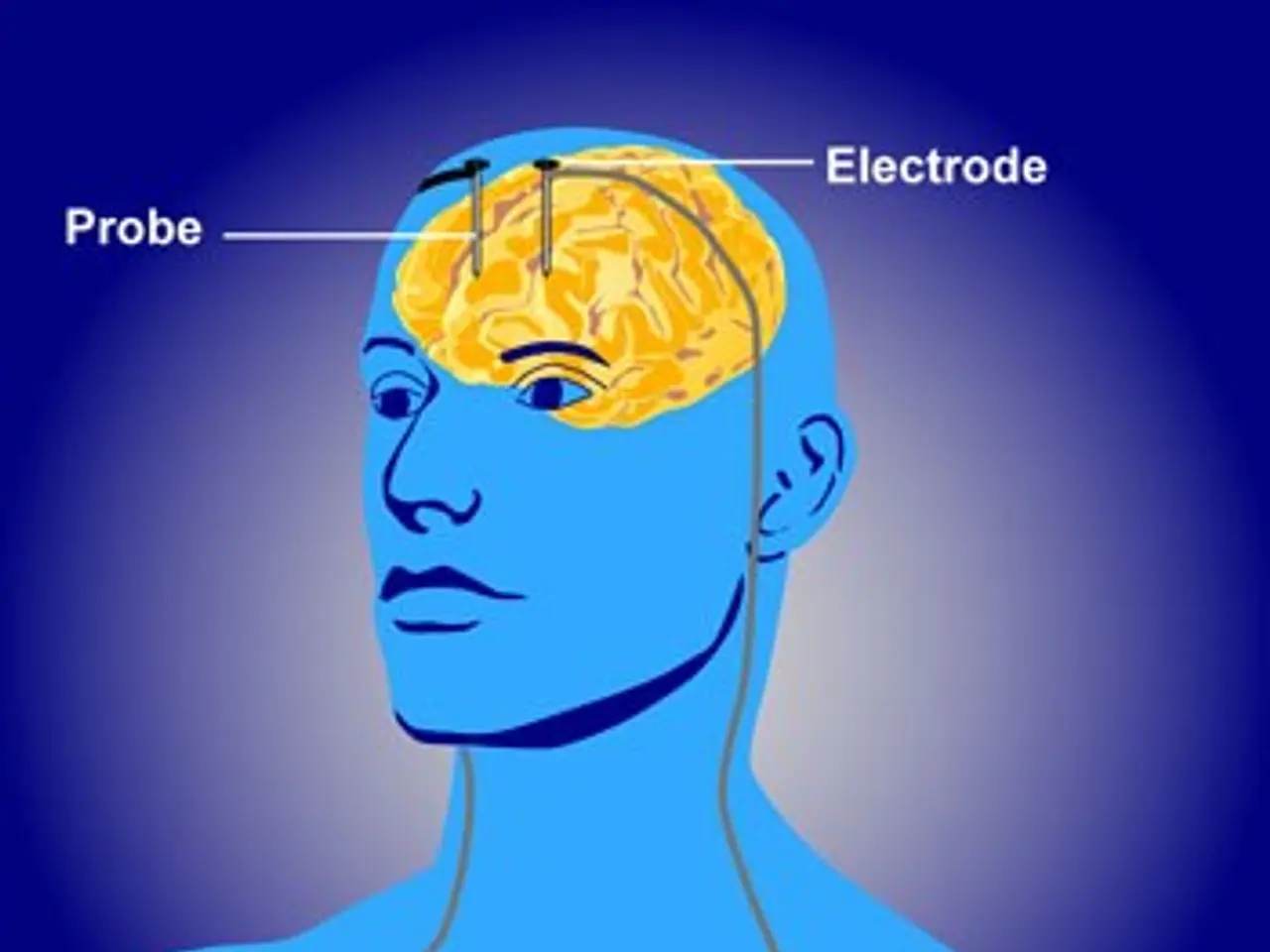 The image shows a diagram of a man's head with electrodes attached to it, indicating that he is...