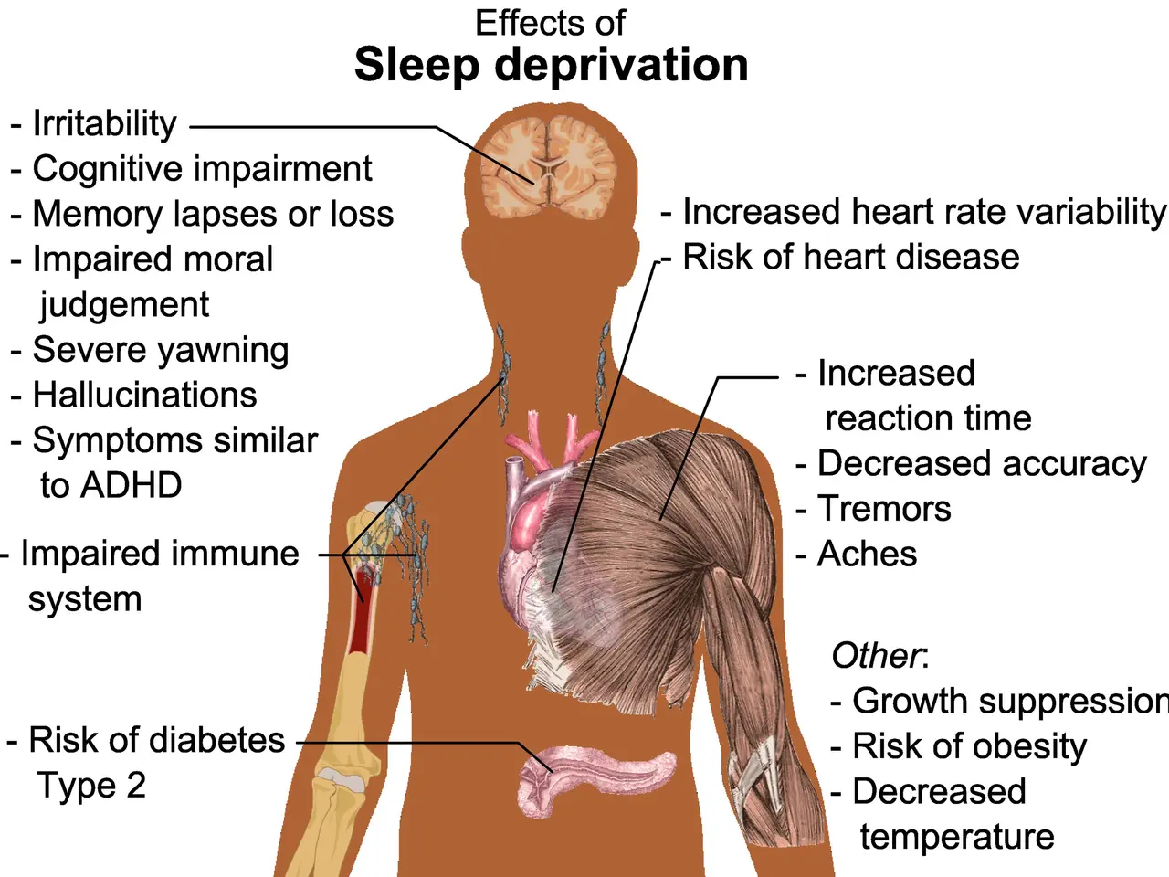 The image shows a diagram of a human body with text on the left side that reads "Effects of Sleep...