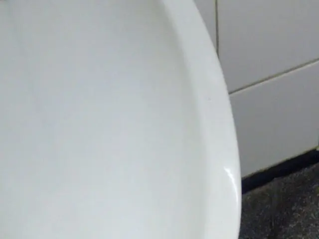 Urine Containing RBC: Meaning, Ranges, and Test Results Interpretation