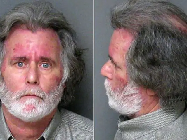 Characteristics and Diagnosis of Narcissistic Personality Disorder, Including Manifestations and...