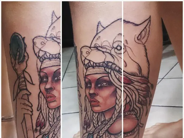 Tips for Understanding Male Breast Reduction Procedures