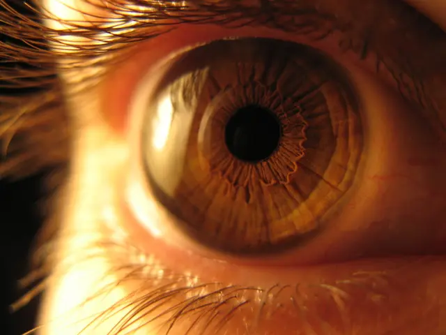 Surgical Remedy for Drooping Eyelids: Blepharoplasty Explored