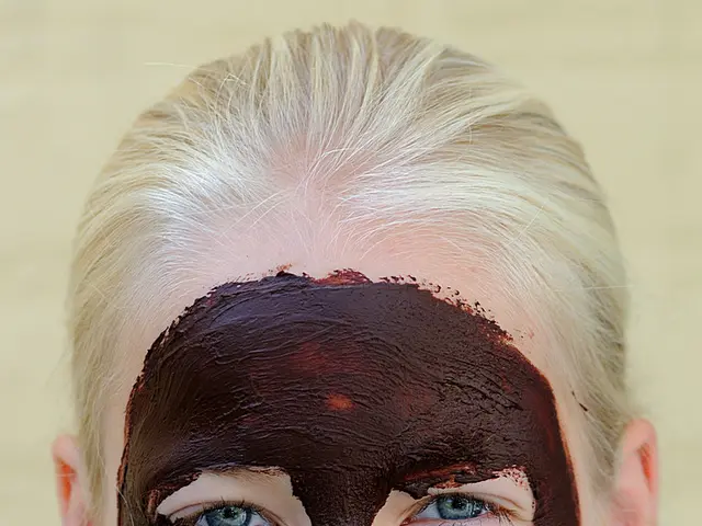 Melanoma with desmoplastic features: Signs, roots, and remedies