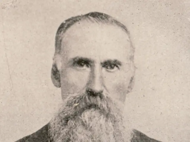 Accelerating Facial Hair Growth: Insights for Rapidly Boosting Your Beard's Progression