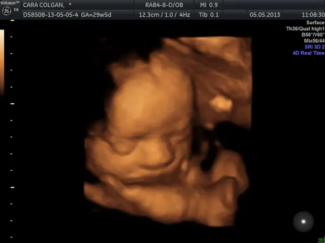 In this image we can see a screen with text and image of a baby.