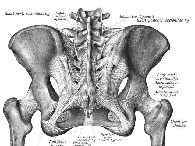 The image shows a black and white diagram of the hip joint, with labels indicating the various...