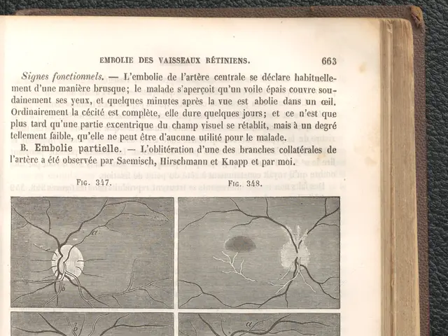 The image shows an open book with a drawing of a brain on it, placed on a surface. The book...