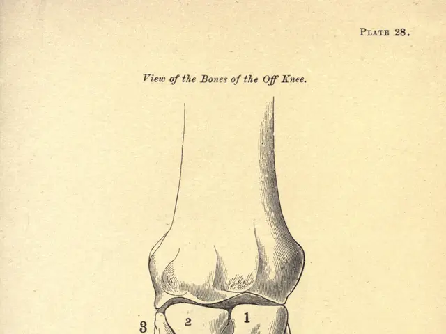 The image shows an old book with a drawing of a knee joint on it. The paper has a picture of the...