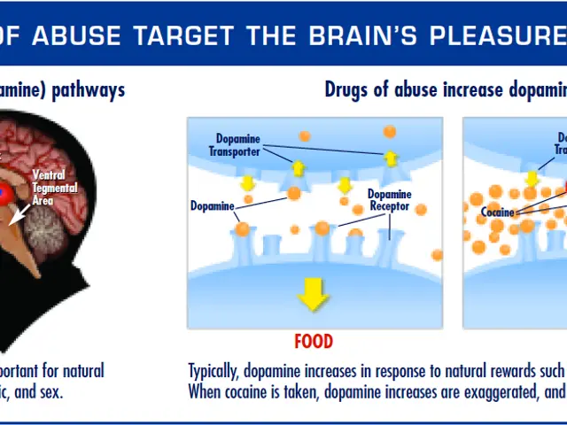 The image shows a poster with a picture of a person's brain on the left side and text at the top...