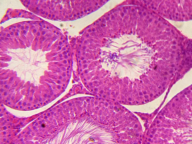The image shows a cross section of a plant stem with a small amount of pink cells, which is a photo...