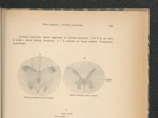 The image shows an open book with a drawing of a brain on it, placed on a surface. The book...