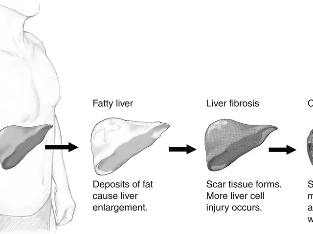 The image shows a diagram of the liver and pancreas, with a drawing of a person on the left side...