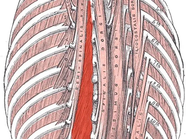 The image shows a diagram of the back of a human body with the muscles of the lower back...