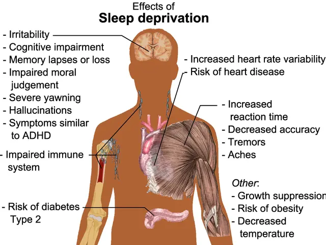 The image shows a diagram of a human body with text on the left side that reads "Effects of Sleep...