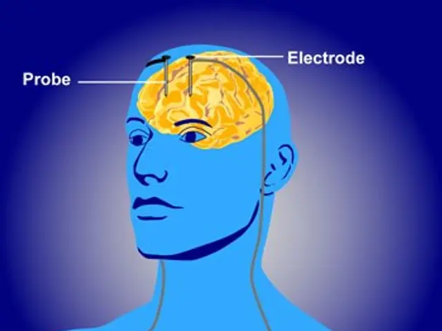 The image shows a diagram of a man's head with electrodes attached to it, indicating that he is...