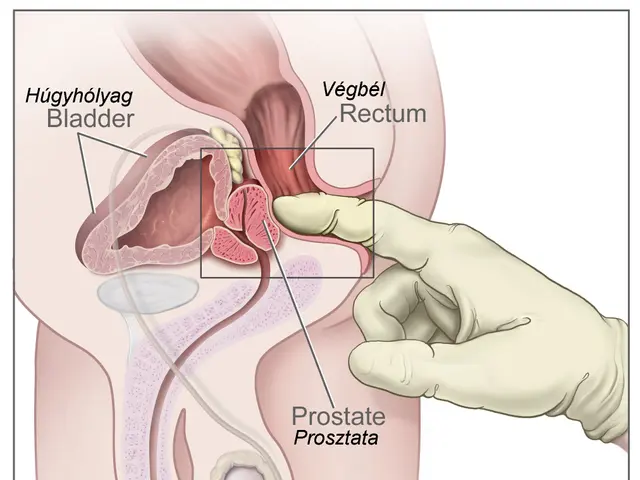 The image shows a diagram of a male reproductive system with a hand pointing to the prostate,...