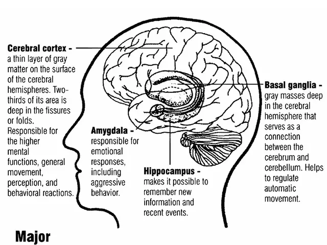 The image shows a diagram of the human brain with the major brain structures implicated in autism...