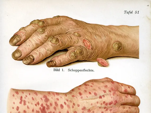 The image shows a book with a drawing of a person's hand with red spots on it, likely caused by...