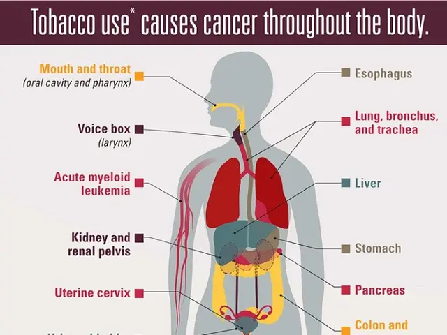 The image shows a poster with a picture of a human body and text that reads "Tobacco Use Causes...