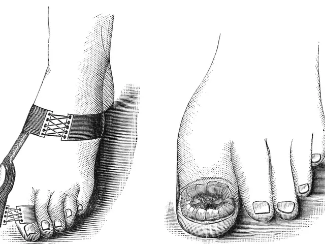 The image shows a black and white drawing of a pair of feet with a bandage on one of them and a...