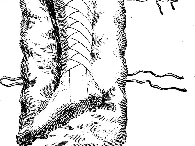 The image shows a black and white drawing of a human foot with a bandage wrapped around it. The...