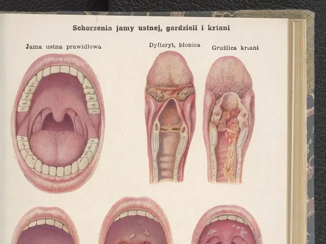 The image shows an open book with pictures of different types of mouths on it, placed on a black...