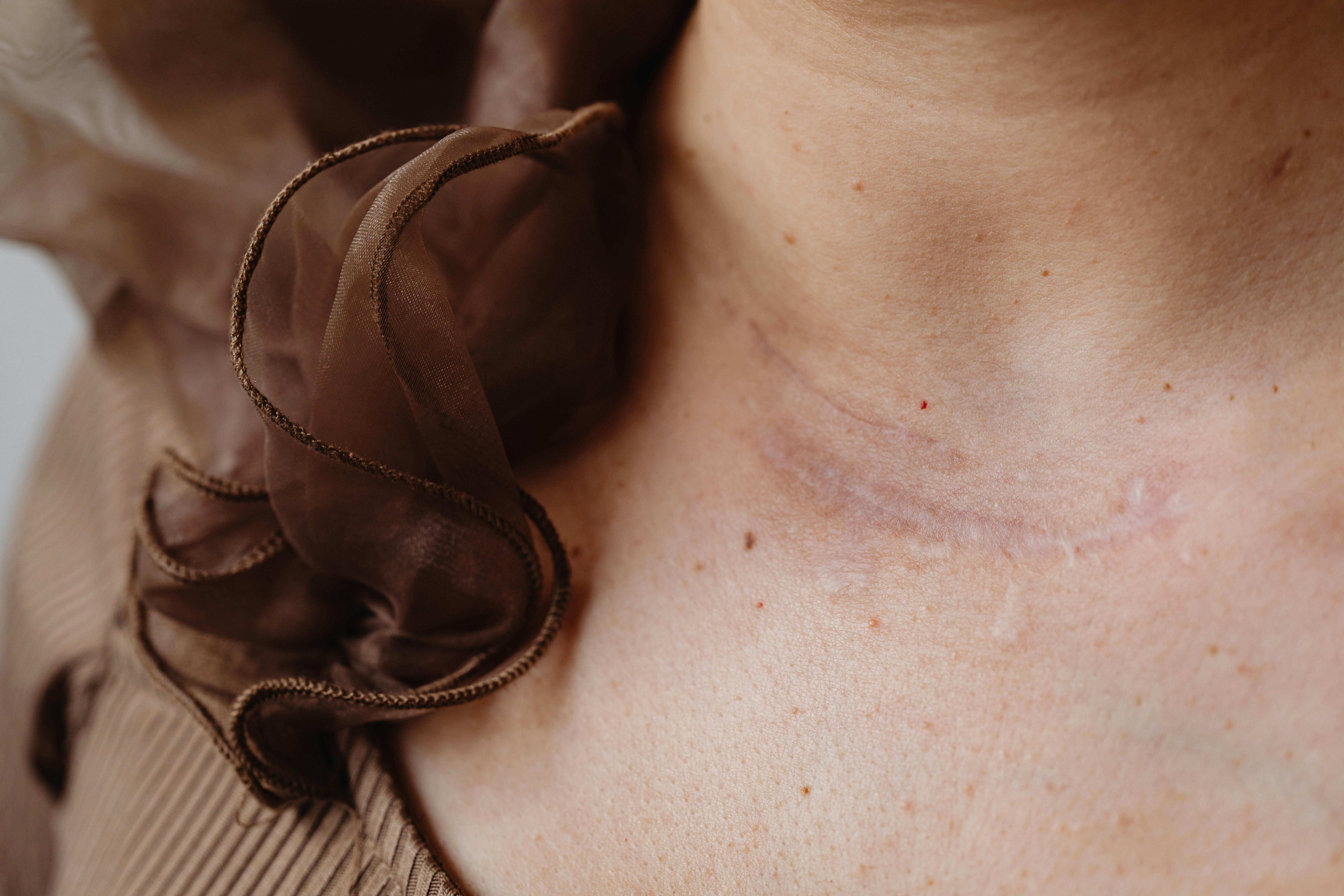 Fighting Off Aging: Top 10 Serums for Minimizing Wrinkles and Acne Marks Fight off Aging: Top 10 Skin Serums for Reducing Wrinkles and Acne Blemishes